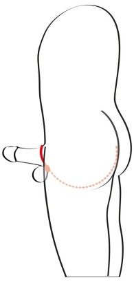 Эрекционное кольцо с цепочкой для стимуляции ягодиц